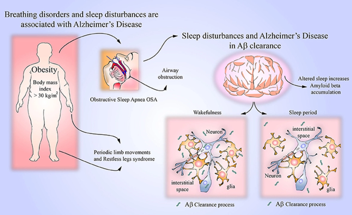 The Connection Between Shift-Work Disorder and Sleep Disorders